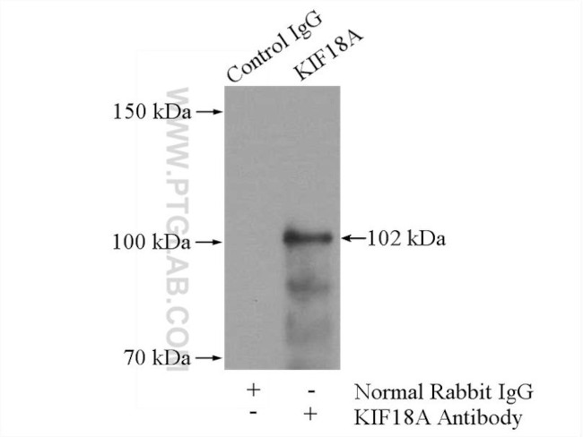 KIF18A Antibody in Immunoprecipitation (IP)