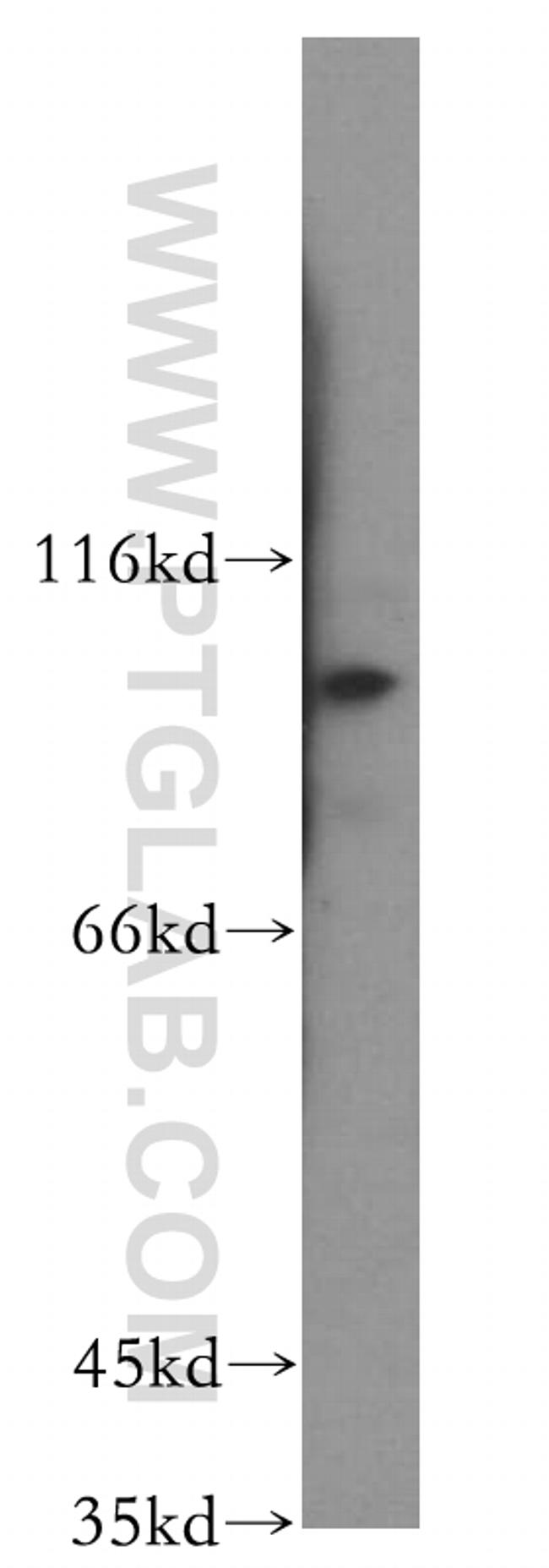 KIF18A Antibody in Western Blot (WB)