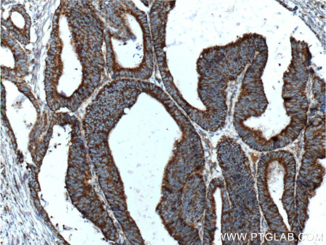 COSMC Antibody in Immunohistochemistry (Paraffin) (IHC (P))