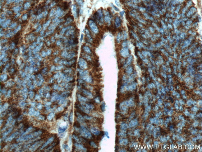 COSMC Antibody in Immunohistochemistry (Paraffin) (IHC (P))