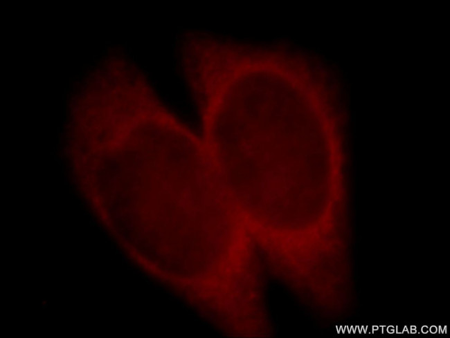 TNFR2 Antibody in Immunocytochemistry (ICC/IF)