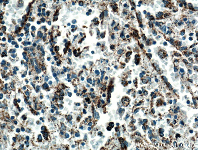 TNFR2 Antibody in Immunohistochemistry (Paraffin) (IHC (P))