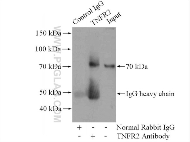 TNFR2 Antibody in Immunoprecipitation (IP)