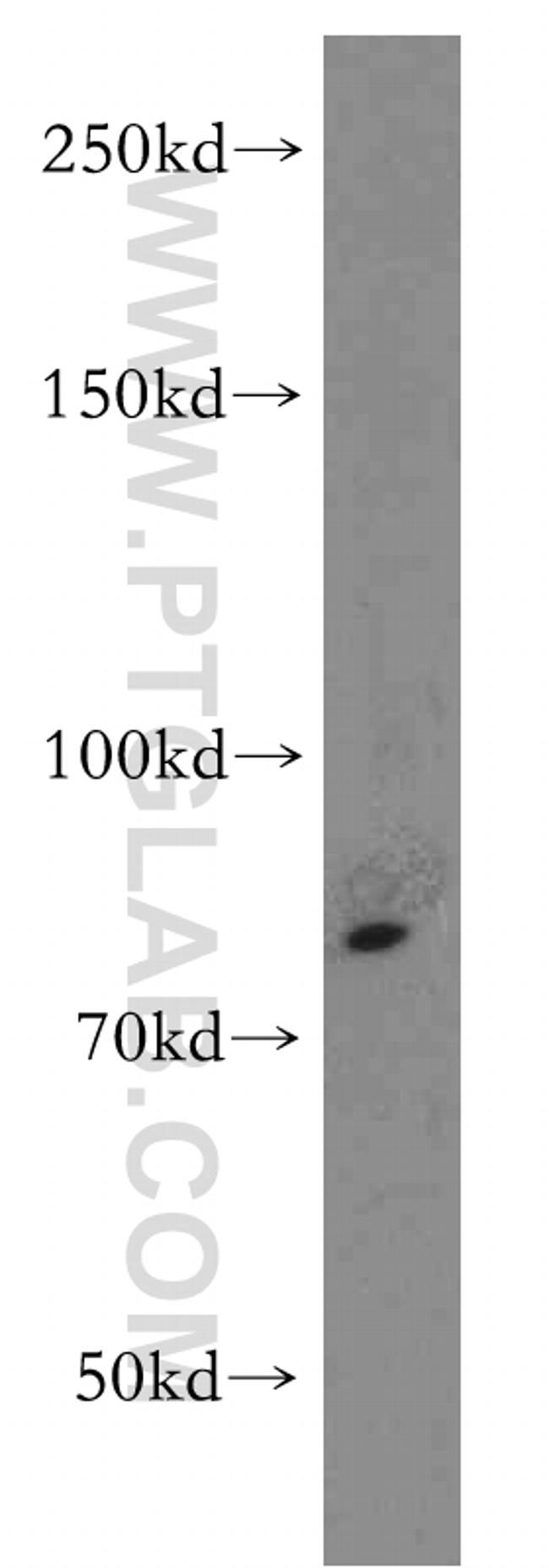 TNFR2 Antibody in Western Blot (WB)