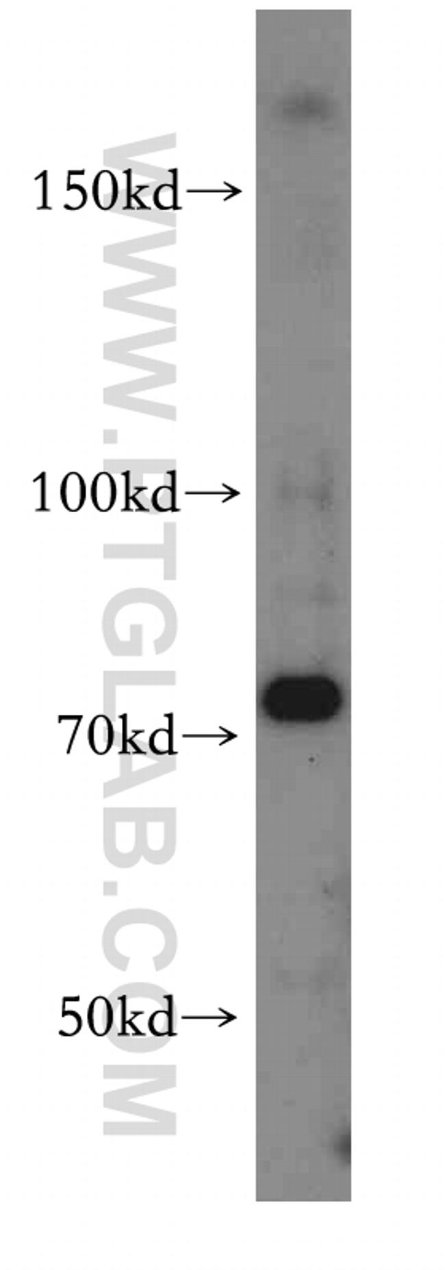 TNFR2 Antibody in Western Blot (WB)