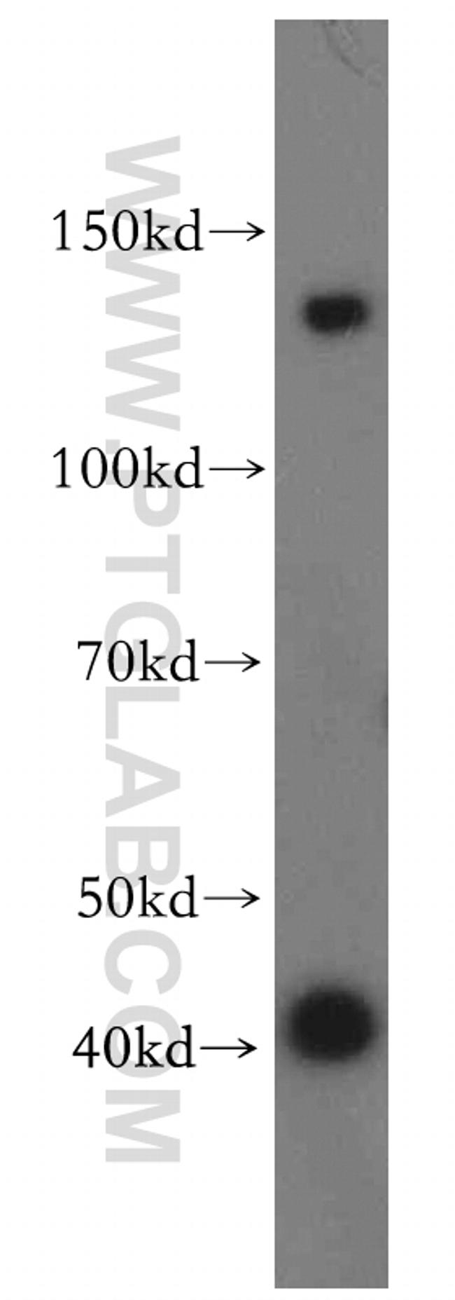 CLCA2 Antibody in Western Blot (WB)