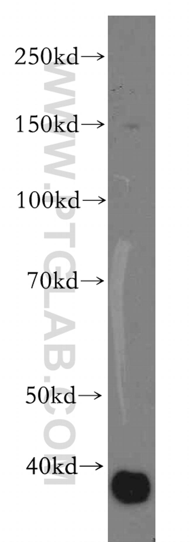 CLCA2 Antibody in Western Blot (WB)