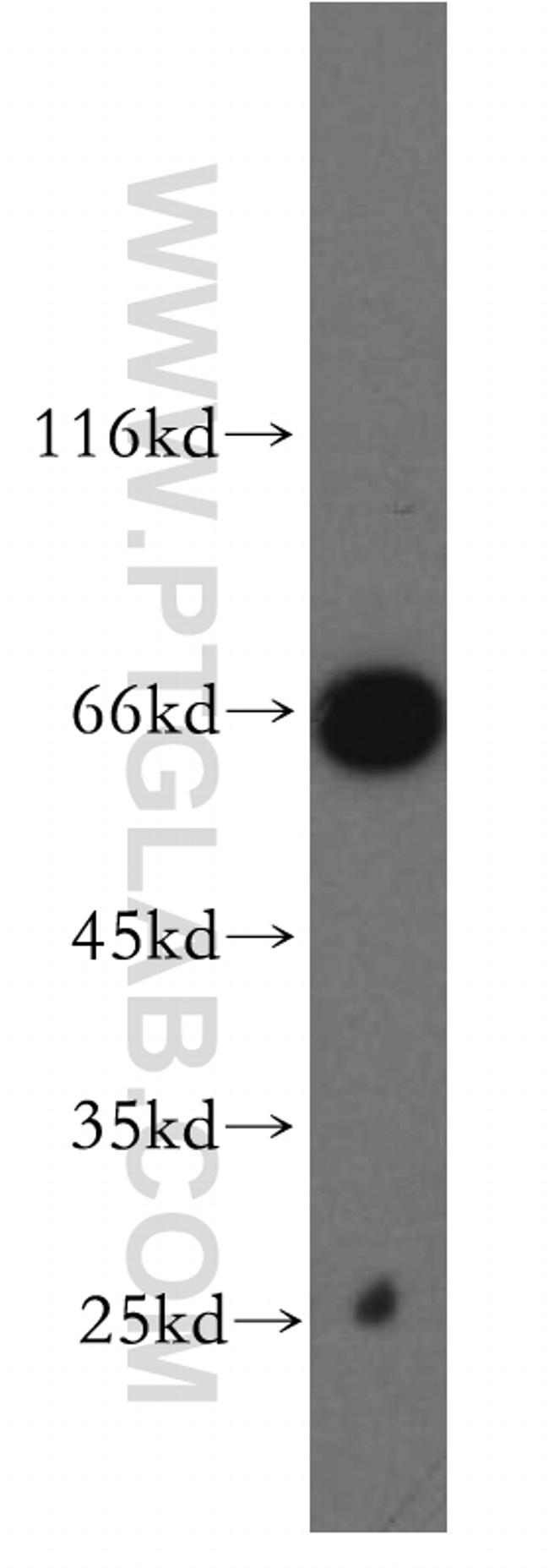 TAF5L Antibody in Western Blot (WB)