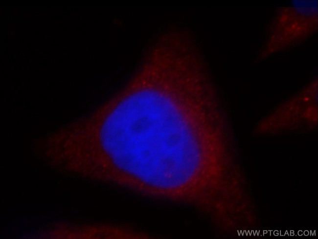 OAS2 Antibody in Immunocytochemistry (ICC/IF)