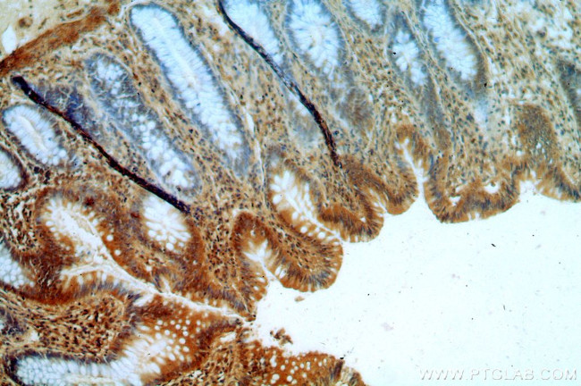 OAS2 Antibody in Immunohistochemistry (Paraffin) (IHC (P))