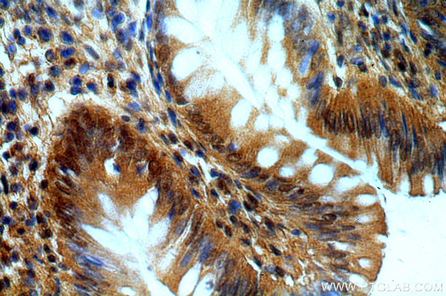 OAS2 Antibody in Immunohistochemistry (Paraffin) (IHC (P))