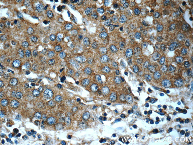 OAS2 Antibody in Immunohistochemistry (Paraffin) (IHC (P))