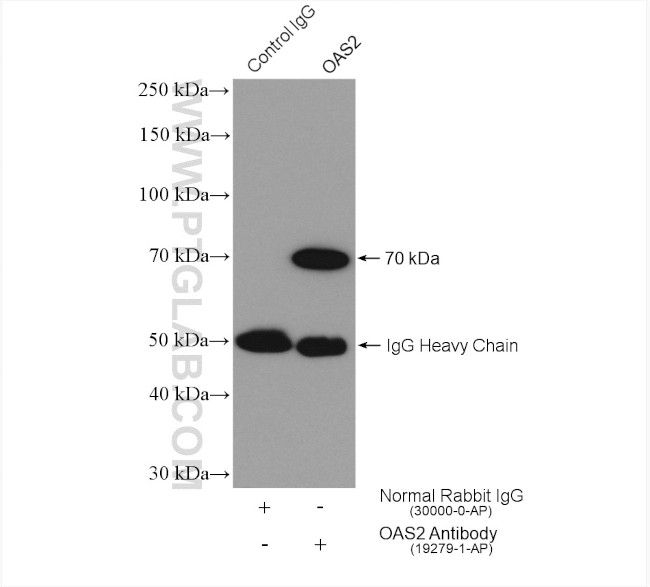 OAS2 Antibody in Immunoprecipitation (IP)