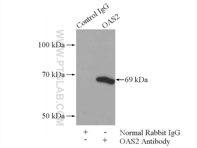 OAS2 Antibody in Immunoprecipitation (IP)