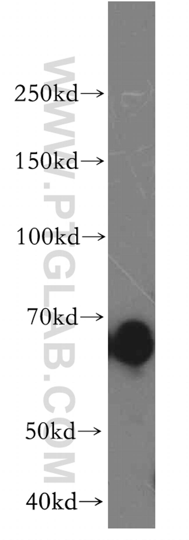 OAS2 Antibody in Western Blot (WB)