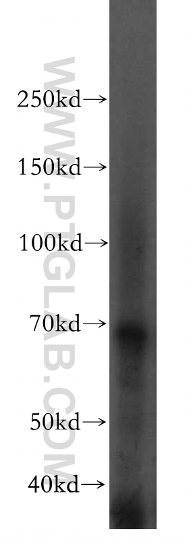 OAS2 Antibody in Western Blot (WB)