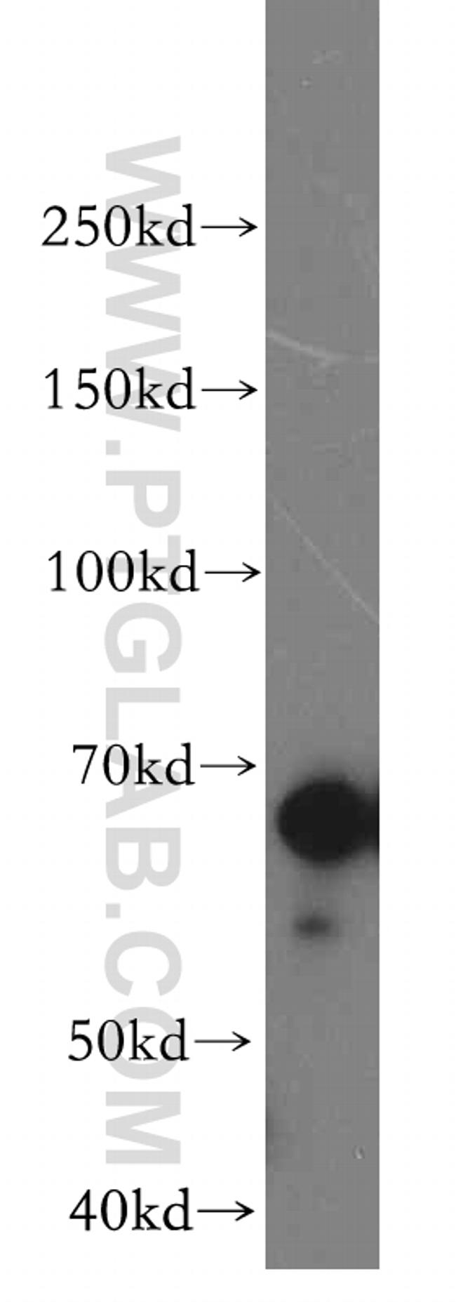 OAS2 Antibody in Western Blot (WB)