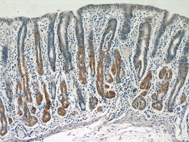 IFT122 Antibody in Immunohistochemistry (Paraffin) (IHC (P))