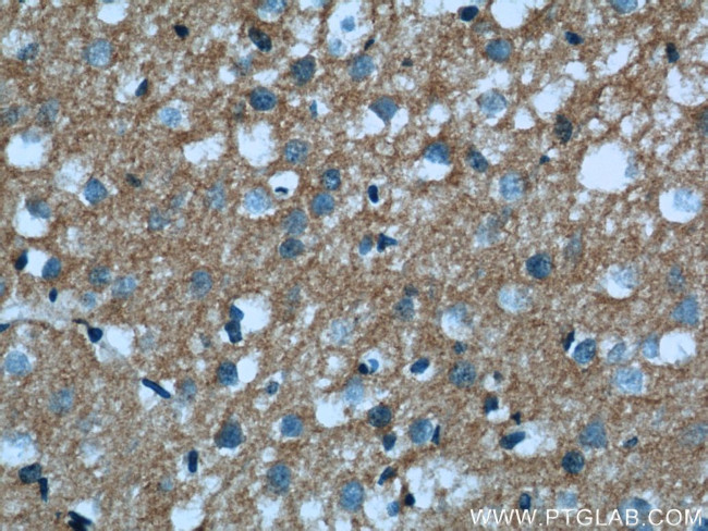 IFT122 Antibody in Immunohistochemistry (Paraffin) (IHC (P))