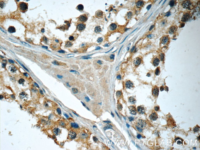 IFT122 Antibody in Immunohistochemistry (Paraffin) (IHC (P))