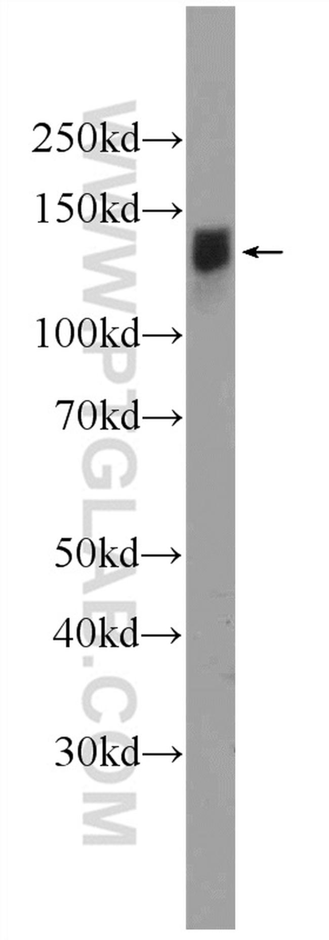 IFT122 Antibody in Western Blot (WB)