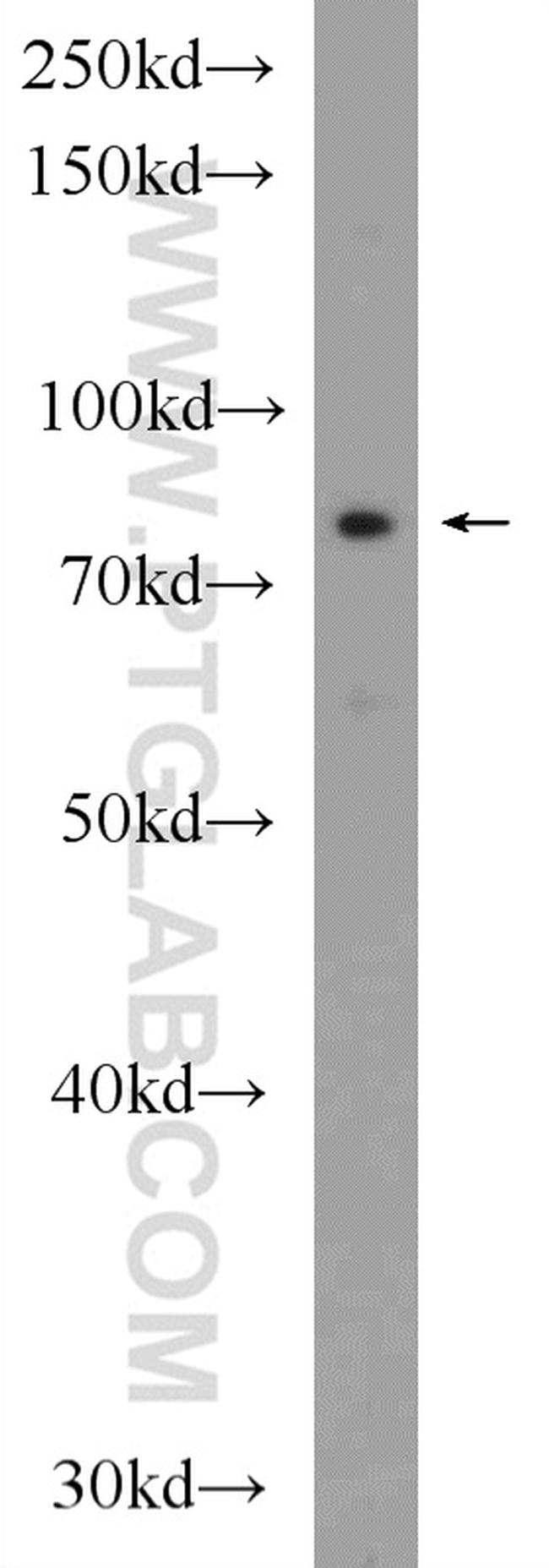 LCA5 Antibody in Western Blot (WB)