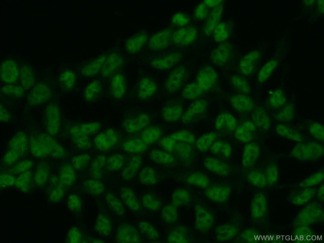 HCFC1 Antibody in Immunocytochemistry (ICC/IF)