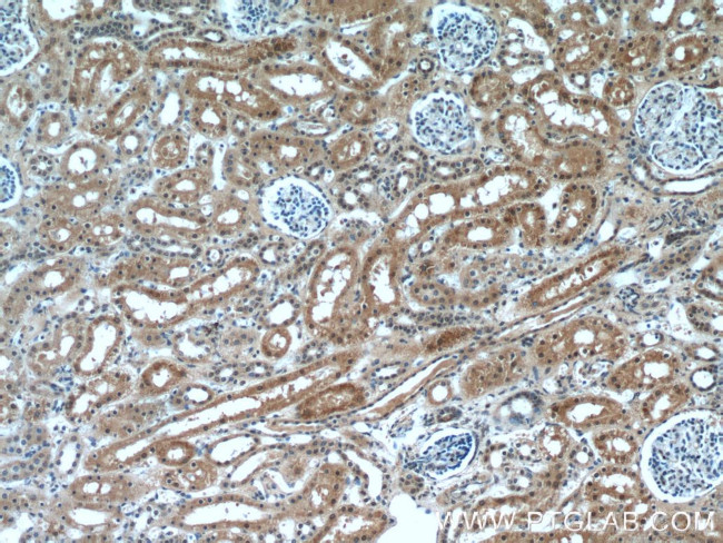 HCFC1 Antibody in Immunohistochemistry (Paraffin) (IHC (P))