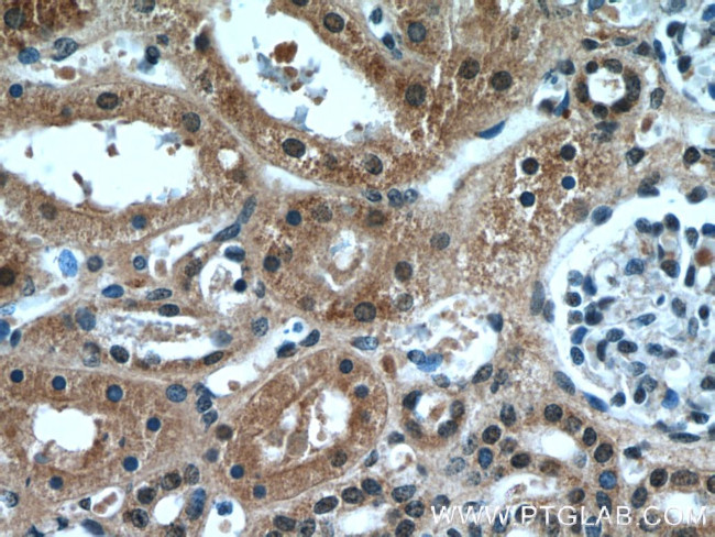 HCFC1 Antibody in Immunohistochemistry (Paraffin) (IHC (P))