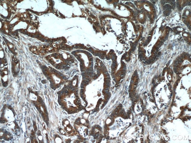 HCFC1 Antibody in Immunohistochemistry (Paraffin) (IHC (P))