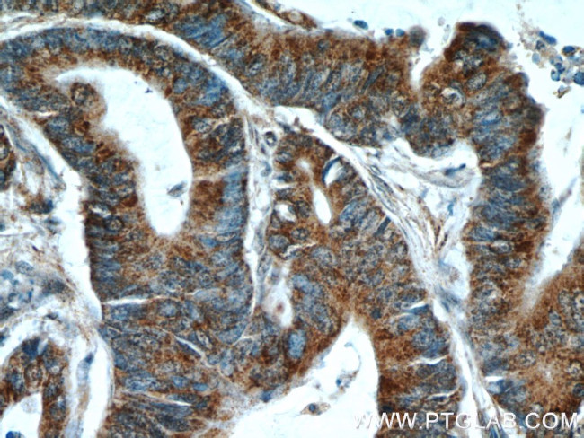 HCFC1 Antibody in Immunohistochemistry (Paraffin) (IHC (P))