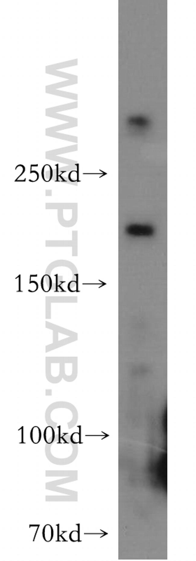 HCFC1 Antibody in Western Blot (WB)