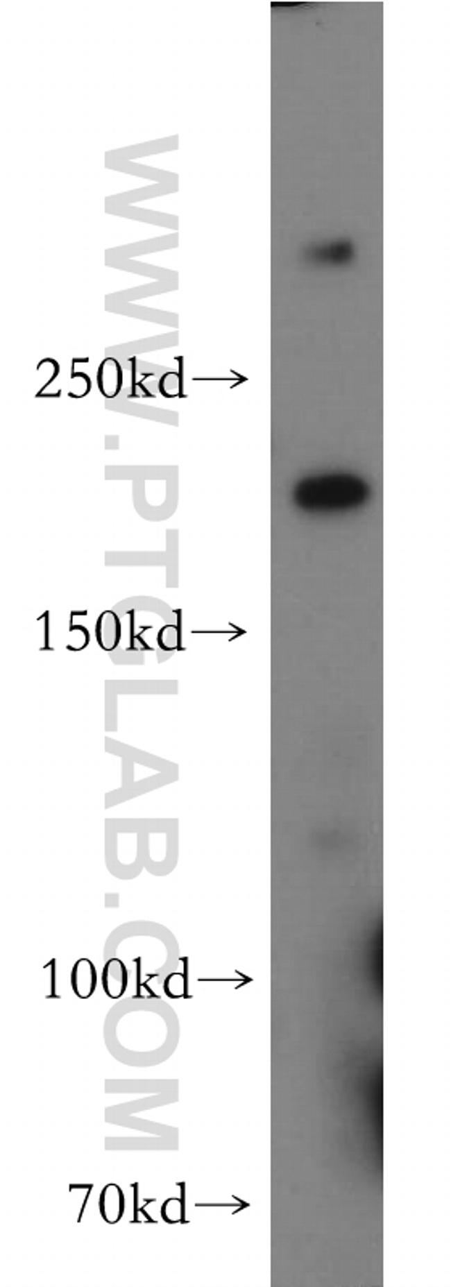 HCFC1 Antibody in Western Blot (WB)