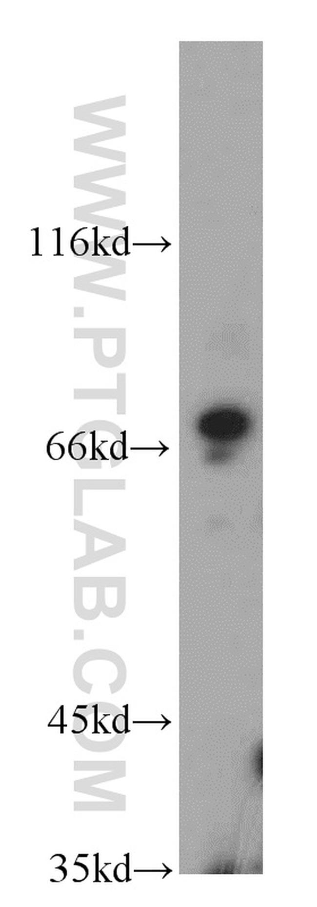 NUP85 Antibody in Western Blot (WB)