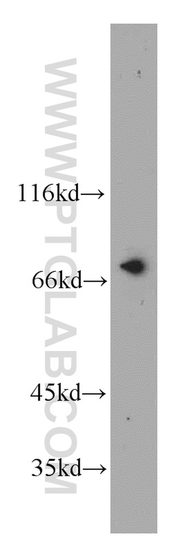 NUP85 Antibody in Western Blot (WB)