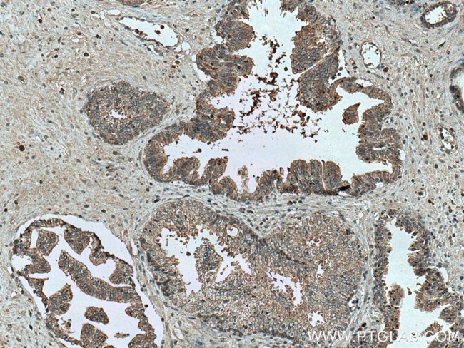 CD57 Antibody in Immunohistochemistry (Paraffin) (IHC (P))