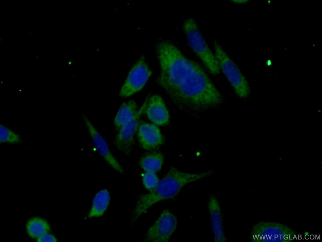 ABHD14A Antibody in Immunocytochemistry (ICC/IF)