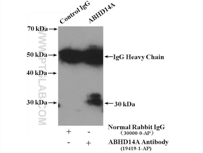 ABHD14A Antibody in Immunoprecipitation (IP)