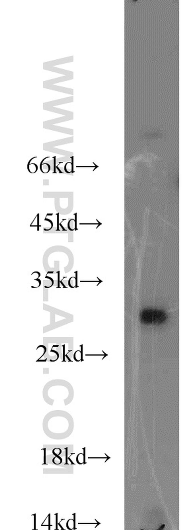 ABHD14A Antibody in Western Blot (WB)