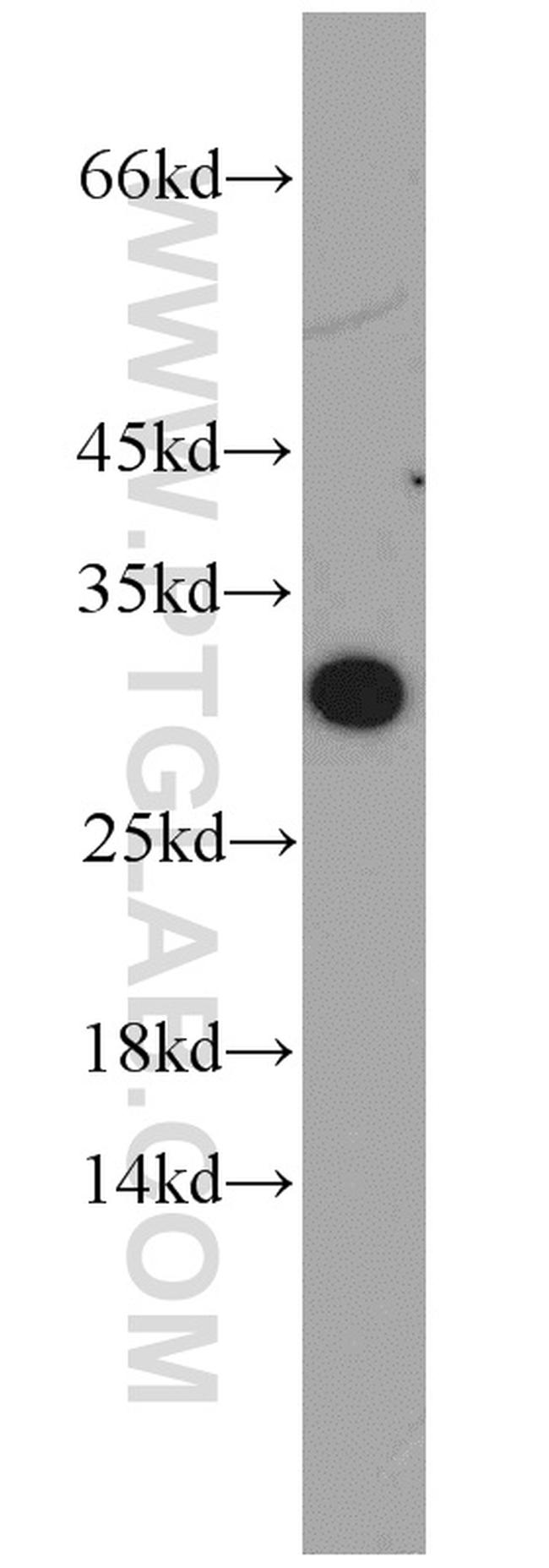 ABHD14A Antibody in Western Blot (WB)