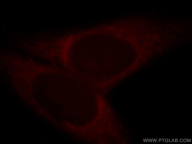 HMP19 Antibody in Immunocytochemistry (ICC/IF)