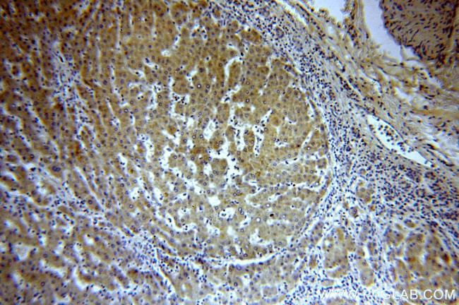 HMP19 Antibody in Immunohistochemistry (Paraffin) (IHC (P))