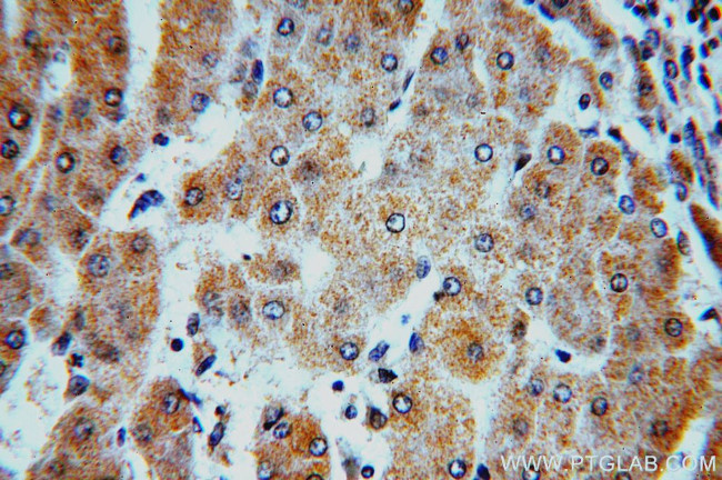 HMP19 Antibody in Immunohistochemistry (Paraffin) (IHC (P))