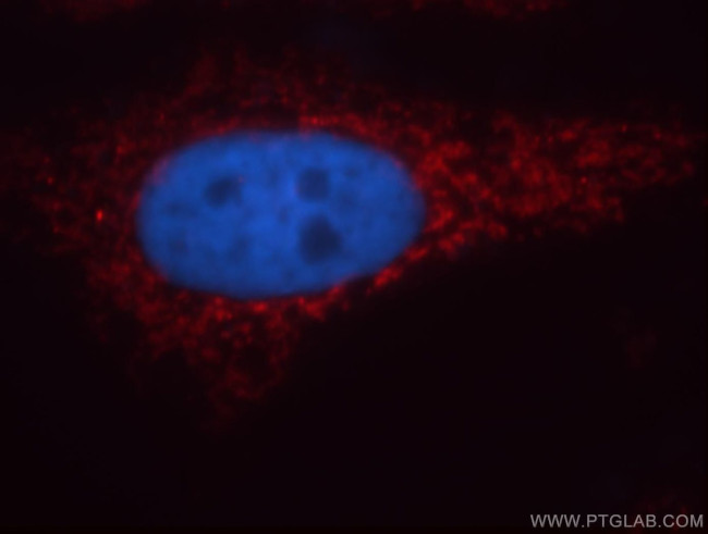 CHCHD2 Antibody in Immunocytochemistry (ICC/IF)