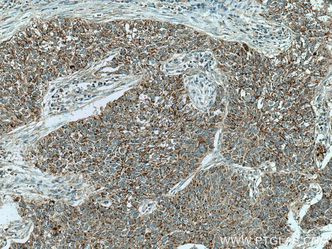 CHCHD2 Antibody in Immunohistochemistry (Paraffin) (IHC (P))