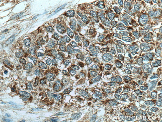 CHCHD2 Antibody in Immunohistochemistry (Paraffin) (IHC (P))