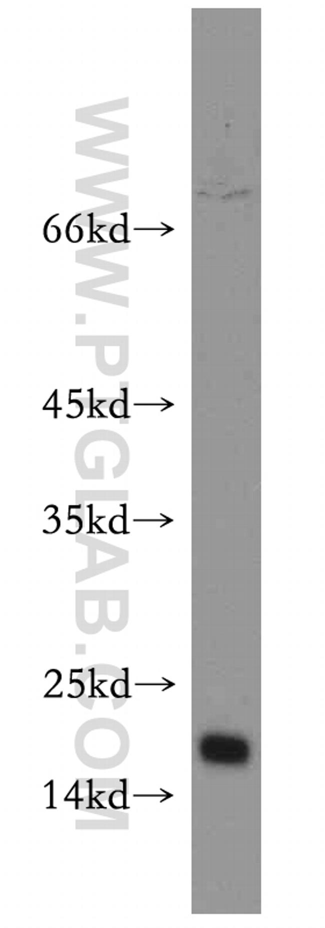 CHCHD2 Antibody in Western Blot (WB)