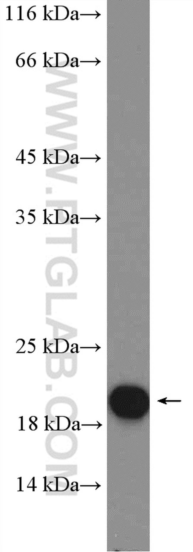 CHCHD2 Antibody in Western Blot (WB)