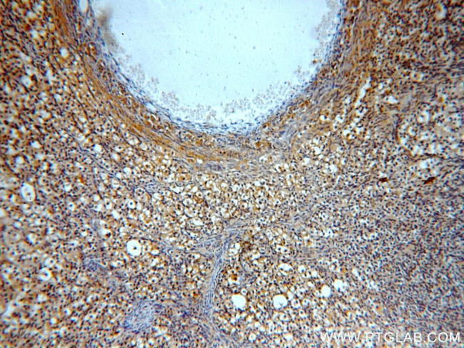 PIH1D1 Antibody in Immunohistochemistry (Paraffin) (IHC (P))