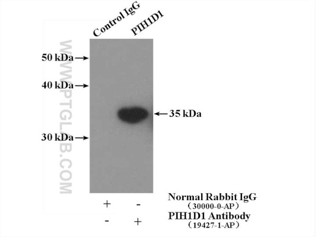 PIH1D1 Antibody in Immunoprecipitation (IP)